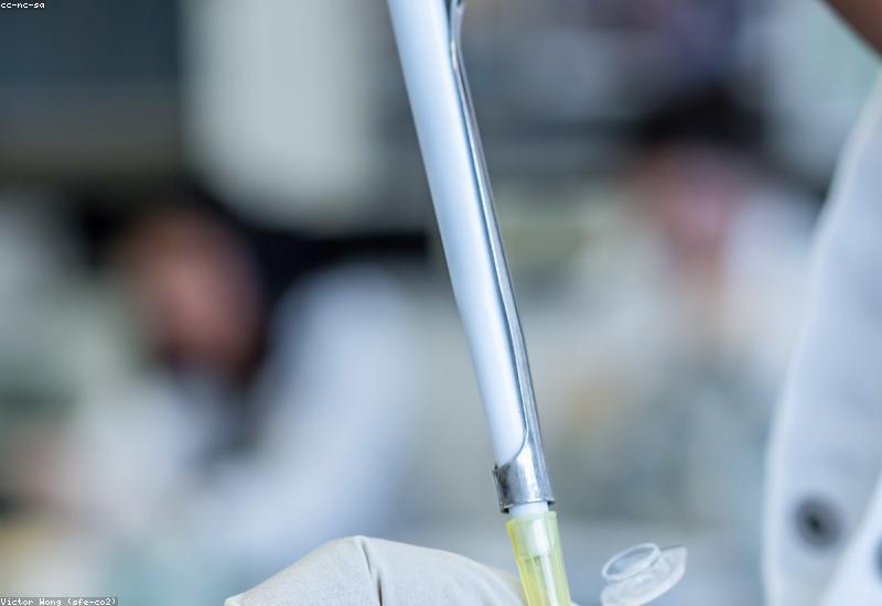 Thyroid Testing