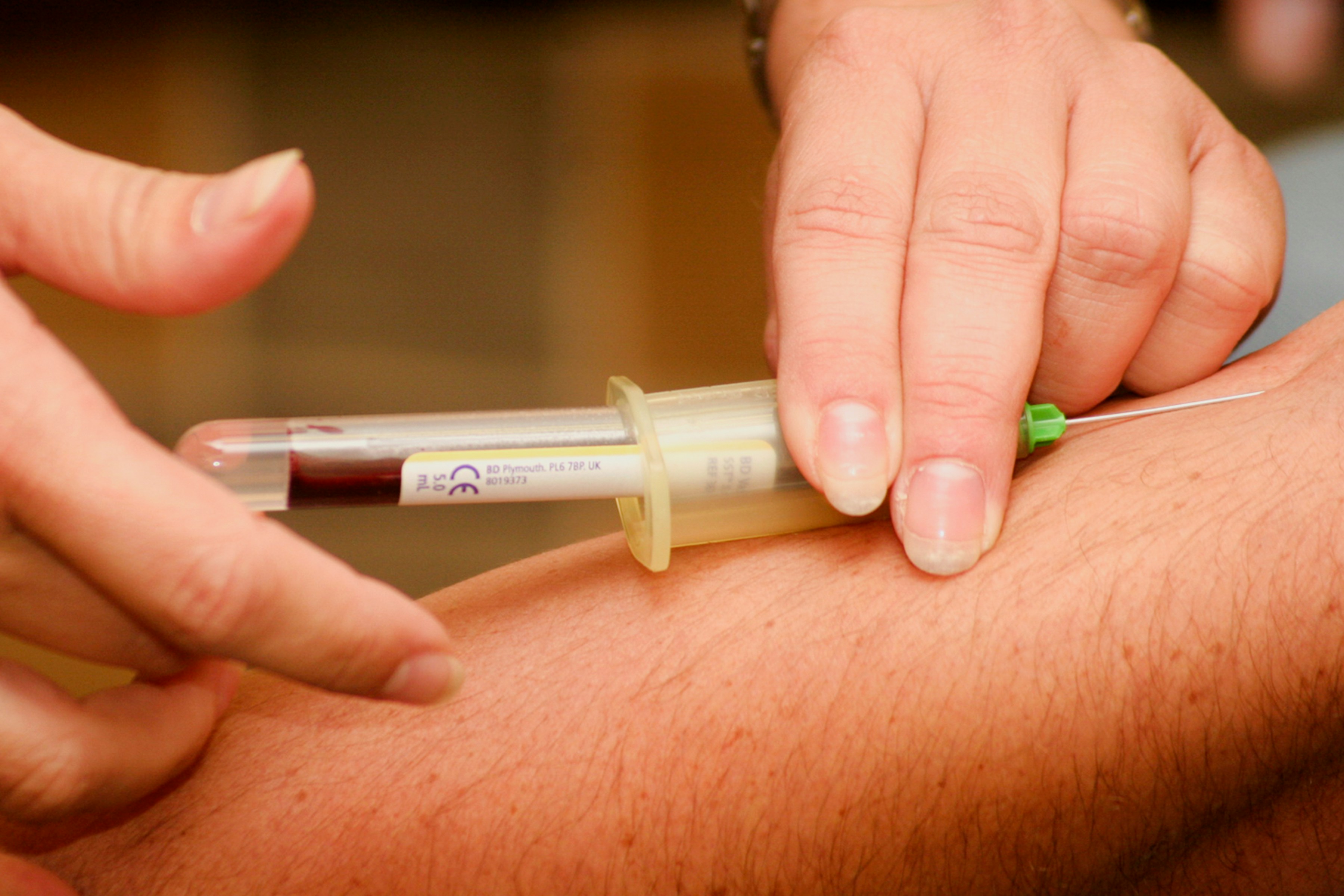 Blood Tests
