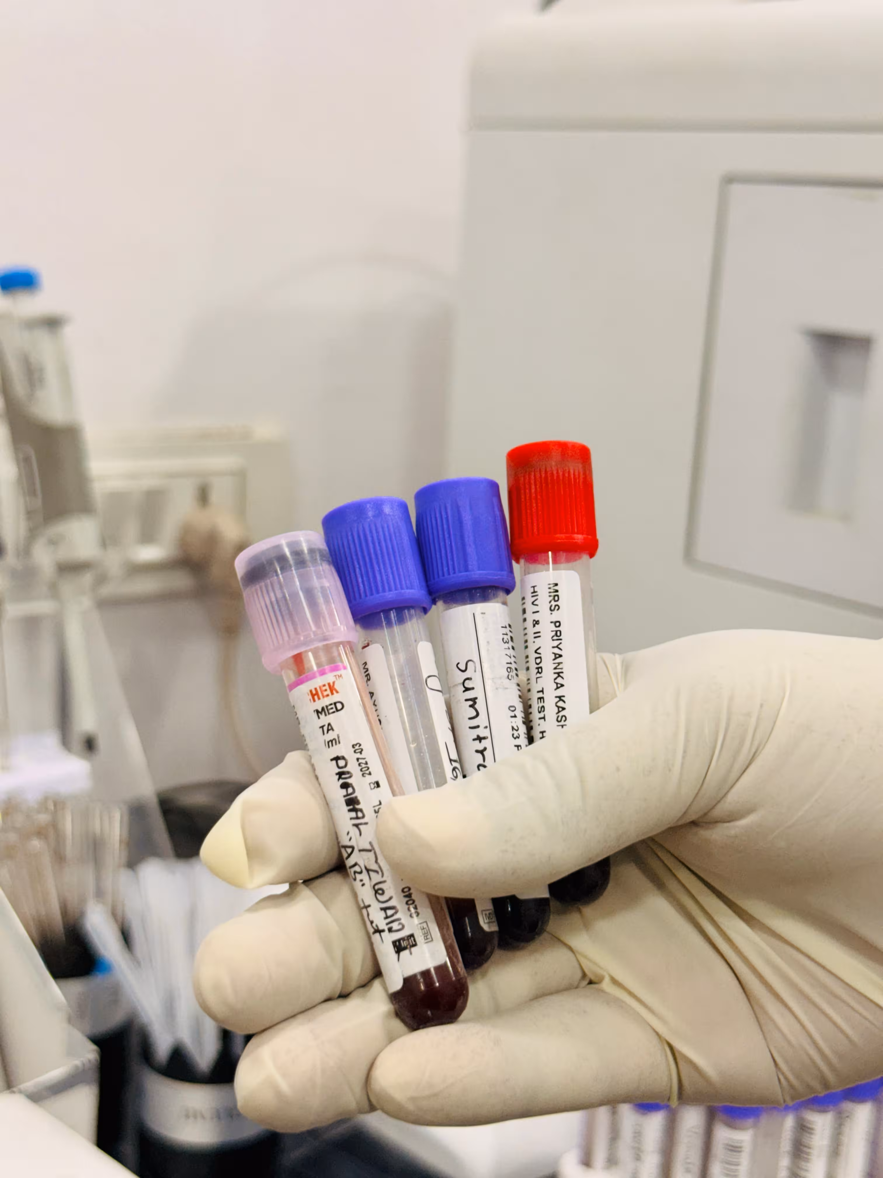 Blood Sample Collection