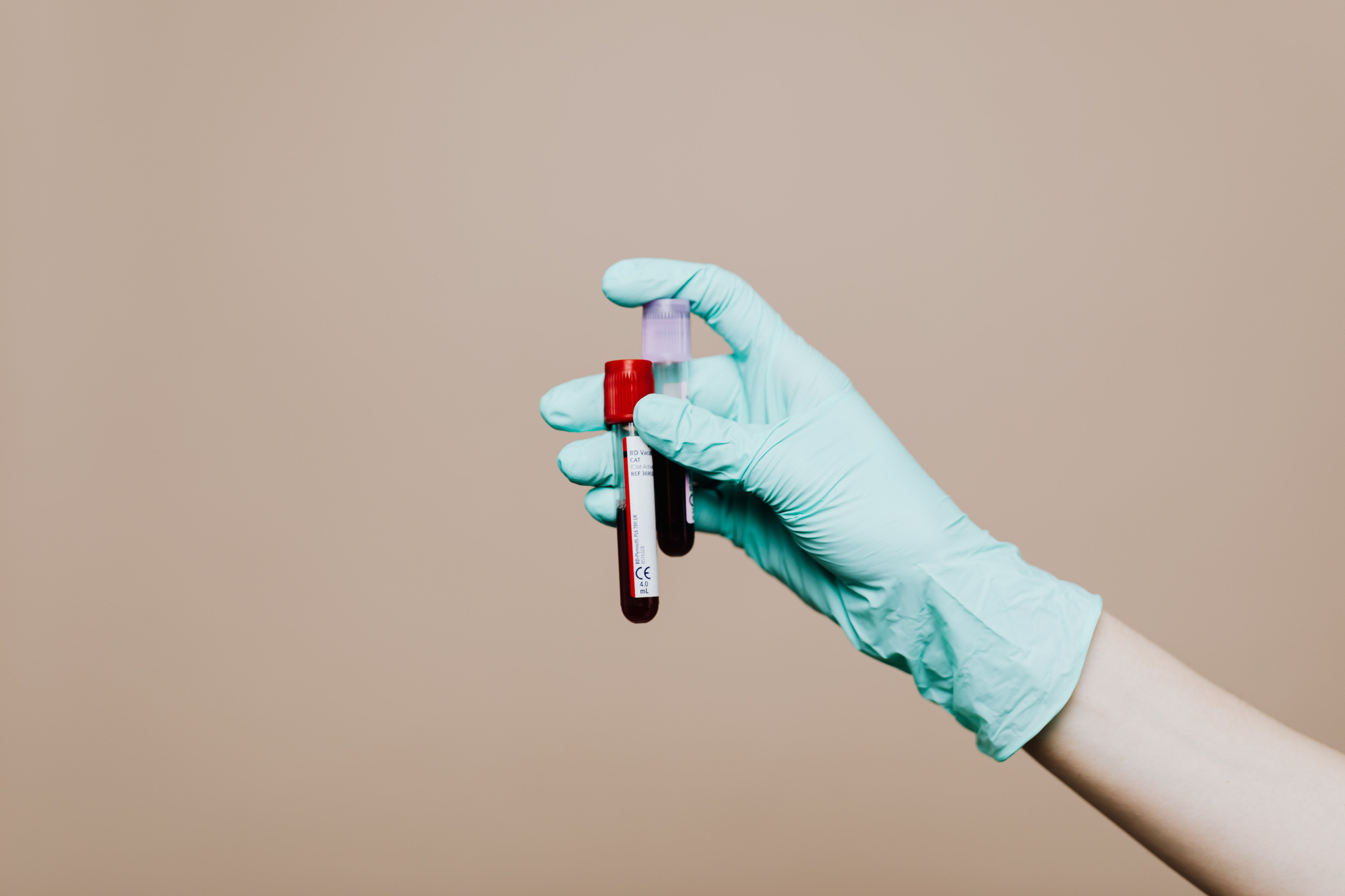 Liver Function Test